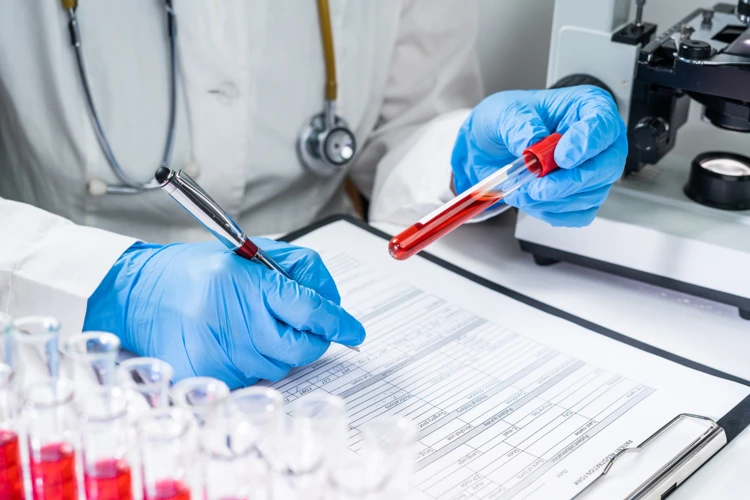 vitamin-deficiency-test