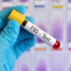 Fasting Blood Sugar (FBS) Test