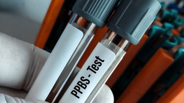 PPBS (Glucose Post Prandial/ Post Prandial Blood Sugar) Test