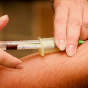 Insulin AntibodyType I & II Diabetes Serum Test