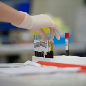 Insulin Post Prandial Serum Test