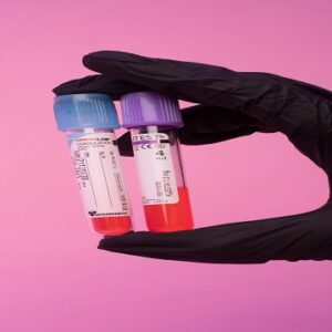 Cortisol Test - Serum