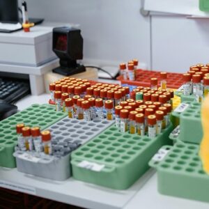 Lipid Profile