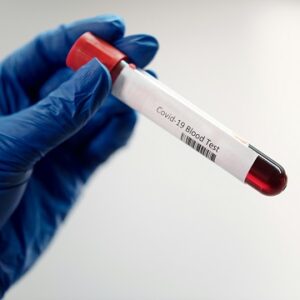 Renal Function Test (RFT)